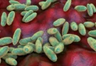 Qué es y cómo se propaga la peste neumónica que se estudia en el laboratorio de Siberia en el que falleció una trabajadora