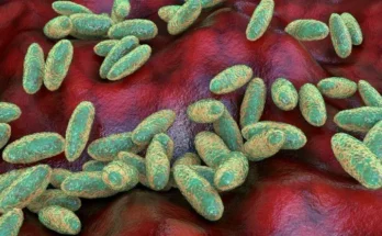 Qué es y cómo se propaga la peste neumónica que se estudia en el laboratorio de Siberia en el que falleció una trabajadora