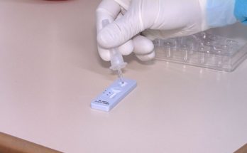 Gobierno habilita el test de antígenos como prueba de Covid para ingresar a Uruguay