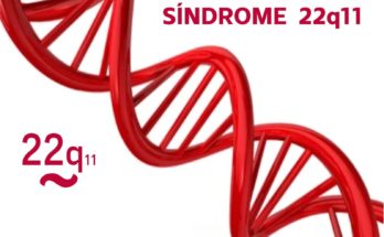 Este 22 de noviembre se conmemora el Día Internacional del Síndrome 22q11