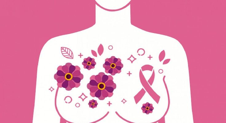 715 mujeres mueren por año de cáncer de mama en Uruguay; especialistas recomiendan la mamografía a partir de los 40