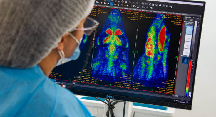 Cudim trabaja en 40 proyectos para mejorar diagnóstico de enfermedades Cudim trabaja en 40 proyectos para mejorar diagnóstico de enfermedades
